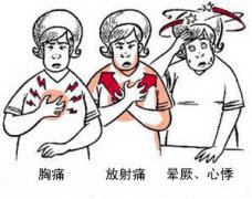 冠心病有哪些癥狀？