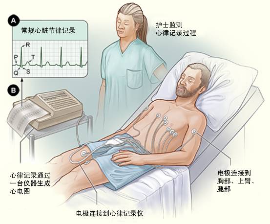 冠心病需要做哪些檢查？(圖1)